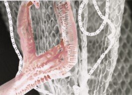 Photogram painted by Chloe Valorso 